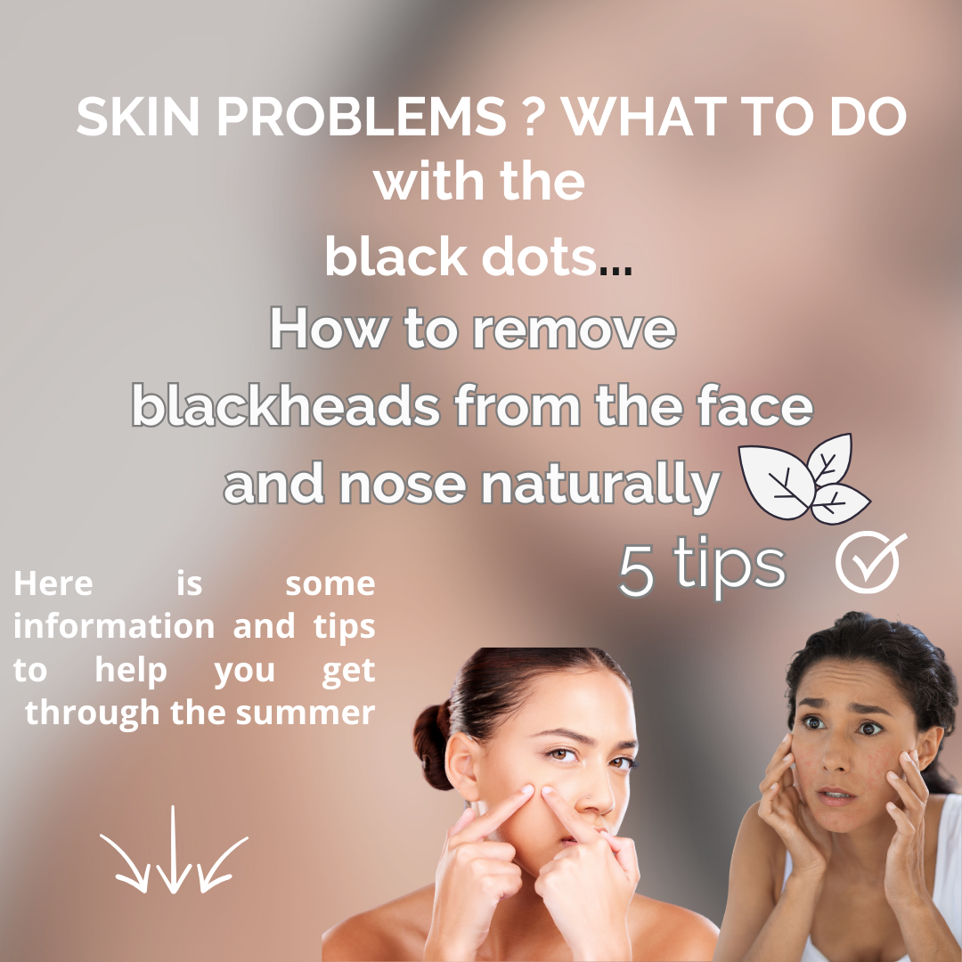 How to remove blackheads from the face and nose naturally?